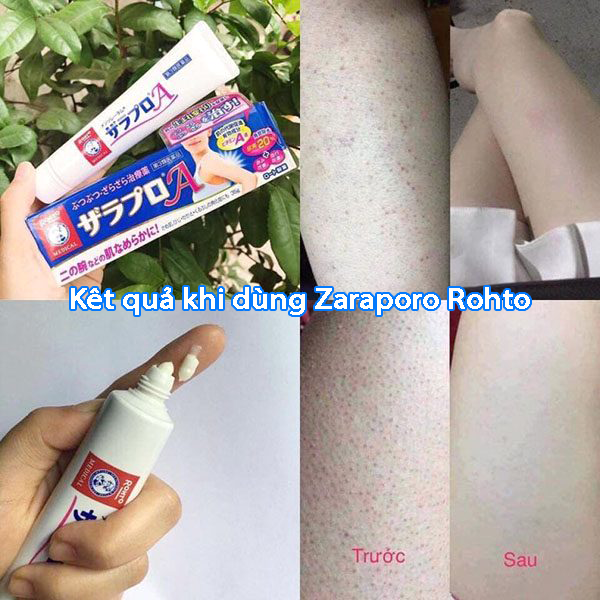 Kết quả sau khi sử dụng kem Zaraporo Rohto